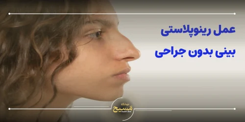 عمل رینوپلاستی بینی بدون جراحی