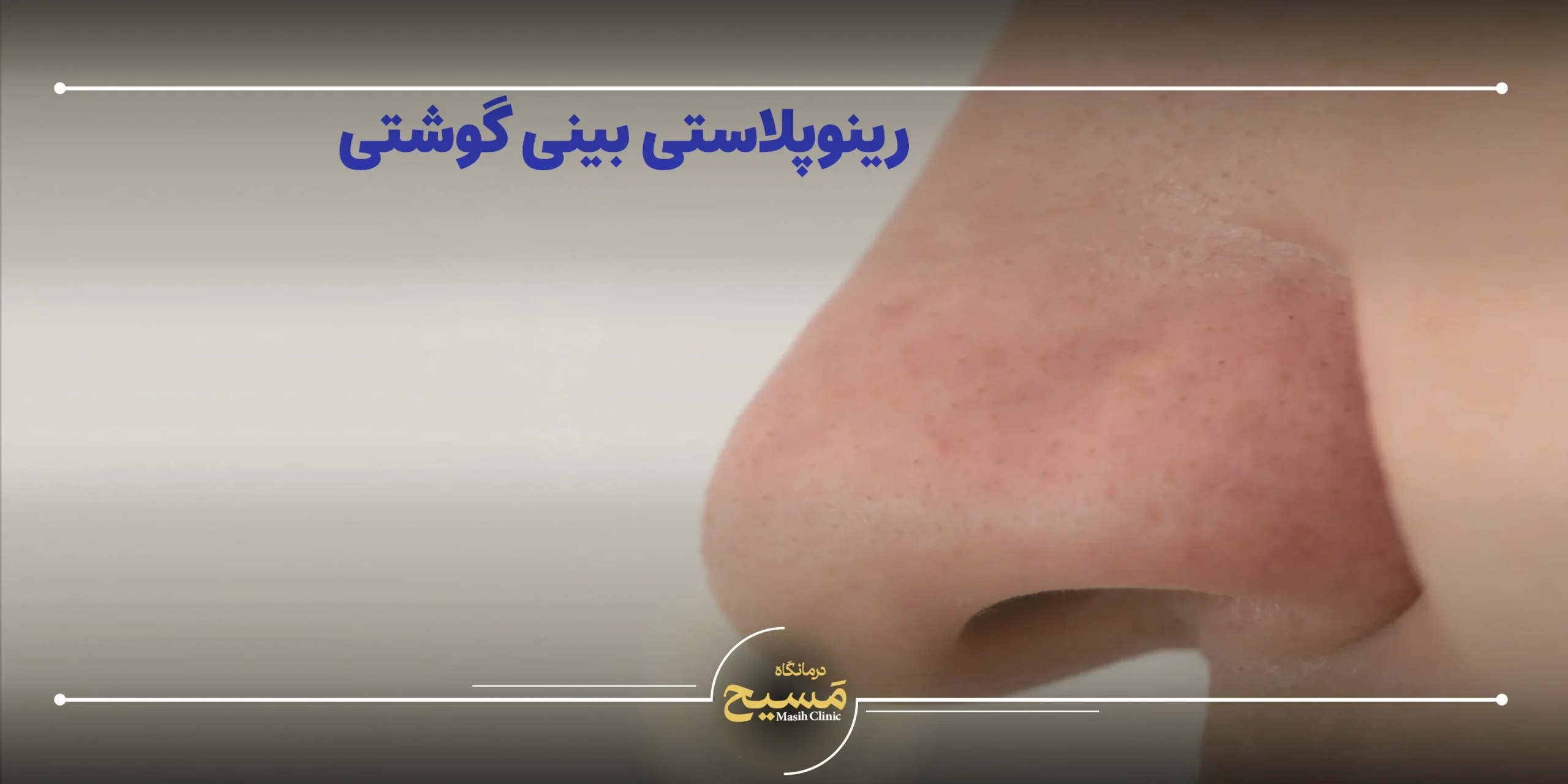 رینوپلاستی بینی گوشتی