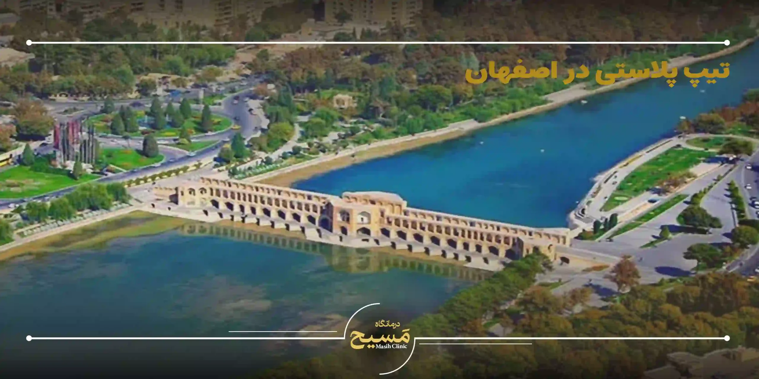 تیپ پلاستی در اصفهان