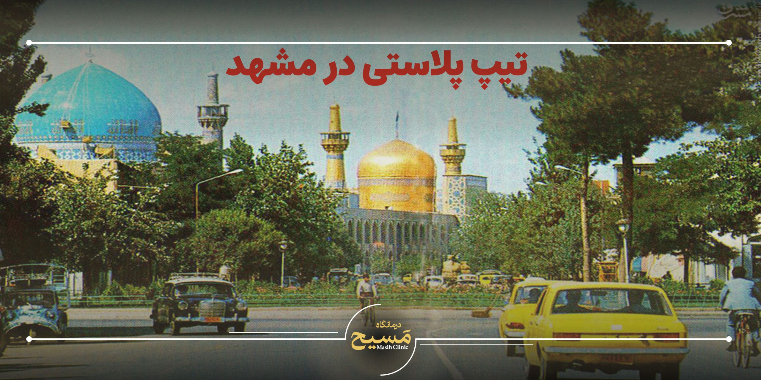 تیپ پلاستی در مشهد