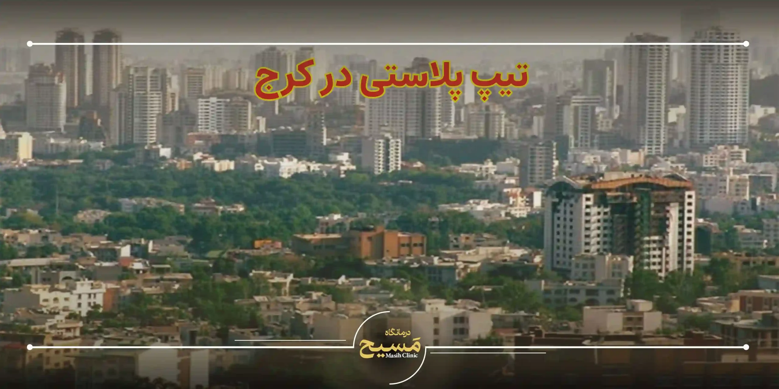 تیپ پلاستی در کرج