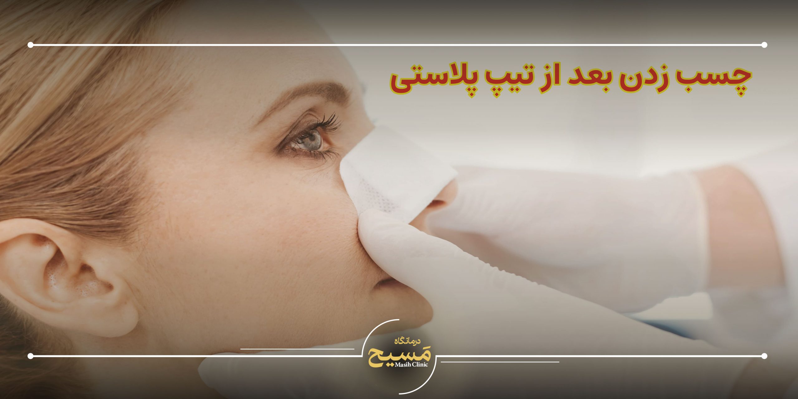 چسب زدن بعد از تیپ پلاستی