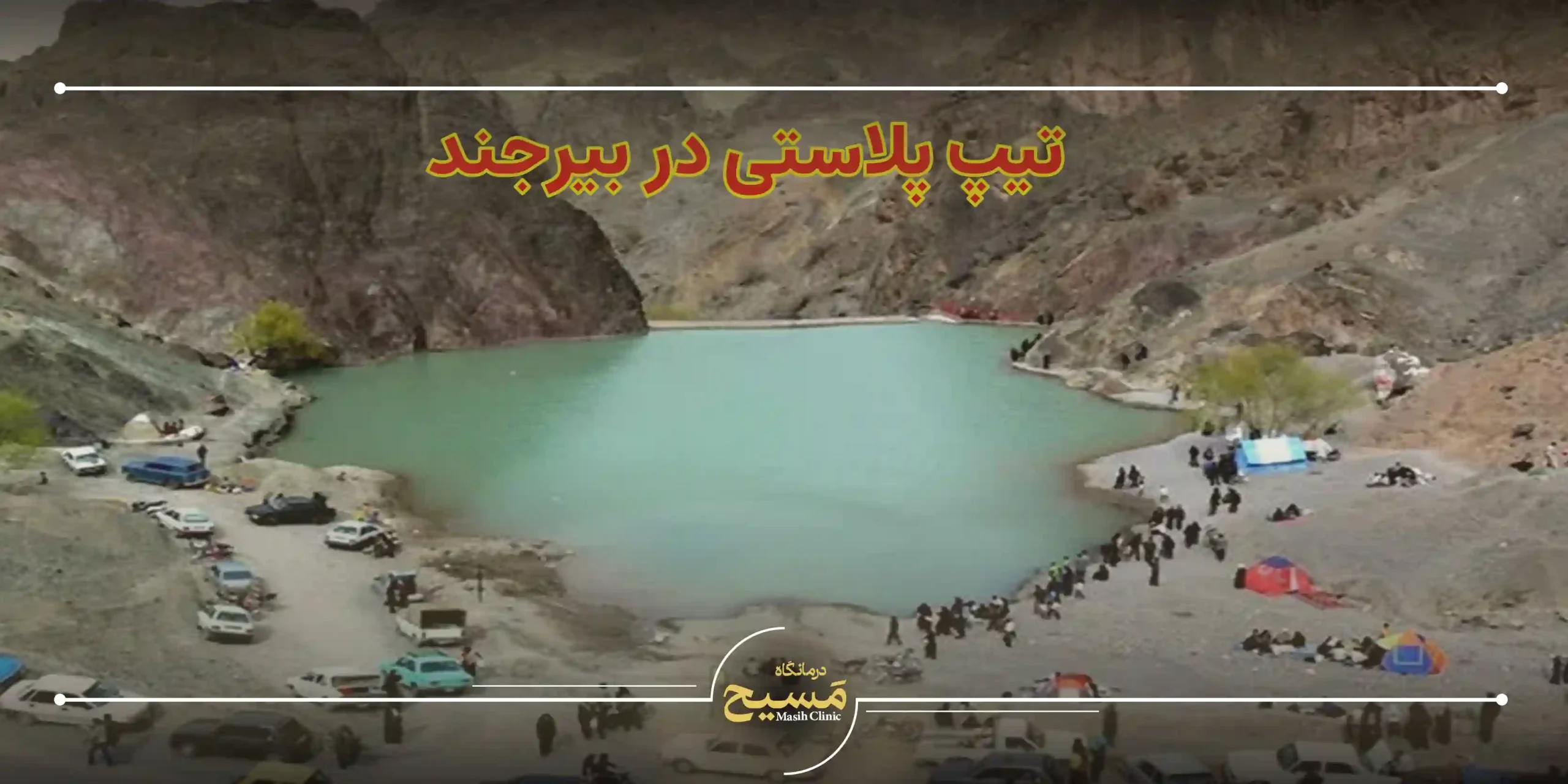 تیپ پلاستی در بیرجند