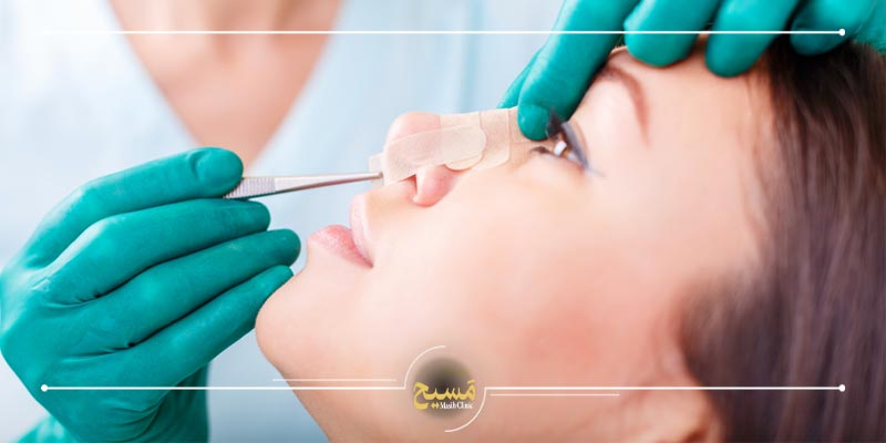 جراحی بینی بدون بیهوشی