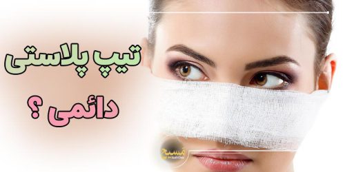 ایا تیپ پلاستی دائمی است