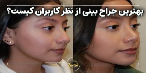 بهترین جراح بینی از نظر کاربران