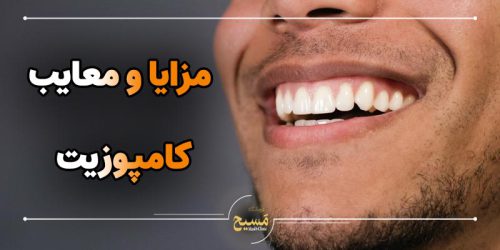 مزایا و معایب کامپوزیت دندان چیست؟