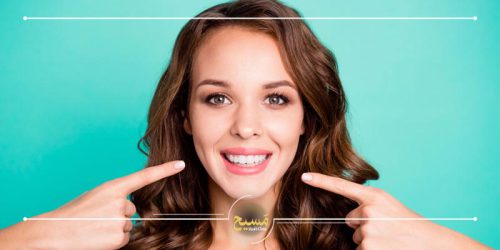 اصلاح طرح لبخند با کامپوزیت