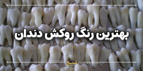 بهترین رنگ روکش دندان