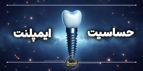 حساسیت به ایمپلنت دندان