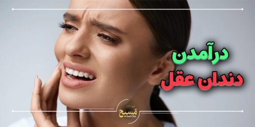 درآمدن دندان عقل چند روز طول میکشد؟