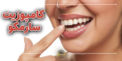 سفید ترین رنگ کامپوزیت سارمکو