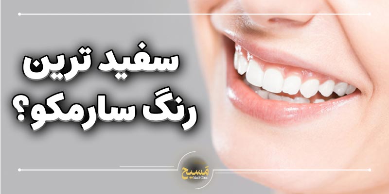 سفید ترین رنگ کامپوزیت سارمکو 1 سفید ترین رنگ کامپوزیت سارمکو کدام است؟