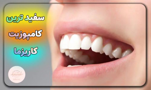 سفیدترین رنگ کامپوزیت کاریزما