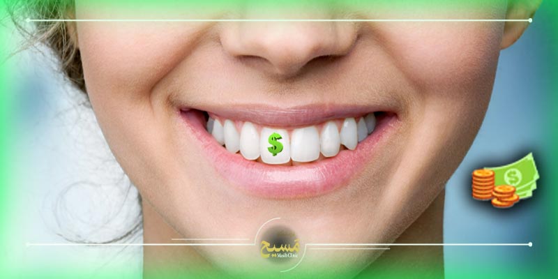 سفید ترین رنگ کامپوزیت سارمکو 2 قیمت سفید ترین رنگ کامپوزیت سارمکو