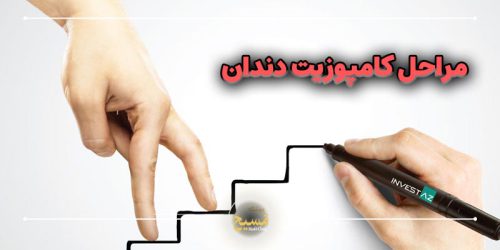 مراحل کامپوزیت دندان