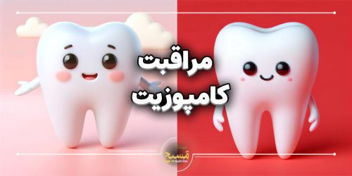 مراقبت های بعد از انجام کامپوزیت