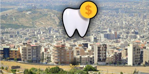 کامپوزیت دندان قسطی در کرج