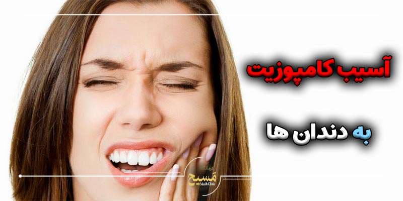 آیا کامپوزیت به دندان آسیب میزند
