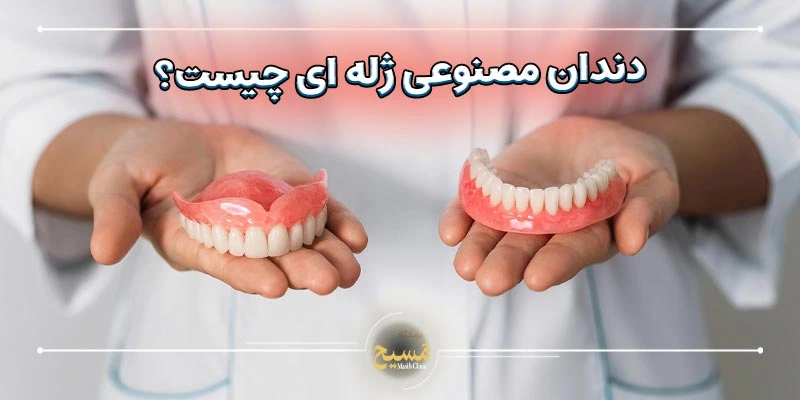 قیمت دندان مصنوعی ژله ای در تهران 1 دندان مصنوعی ژله ای چیست؟