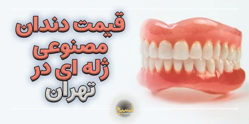 قیمت دندان مصنوعی ژله ای در تهران