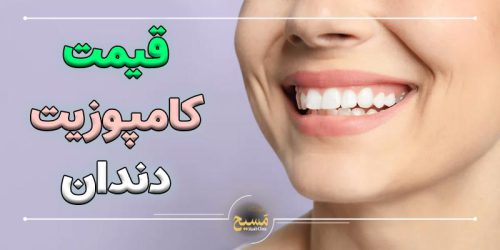 قیمت کامپوزیت دندان