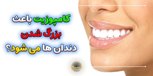 آیا کامپوزیت باعث بزرگ شدن دندان ها میشود؟