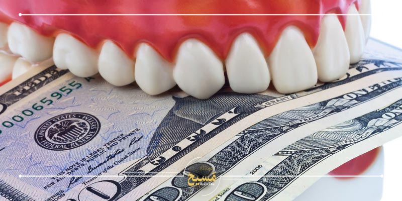 تفاوت قیمت لمینت و کامپوزیت دندان