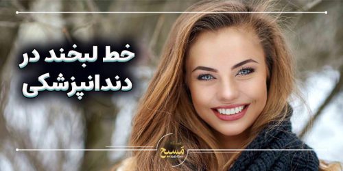 خط لبخند در دندانپزشکی