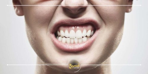 دندان قروچه چیست؟