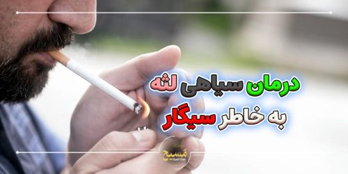 رفع سیاهی لثه ناشی از سیگار