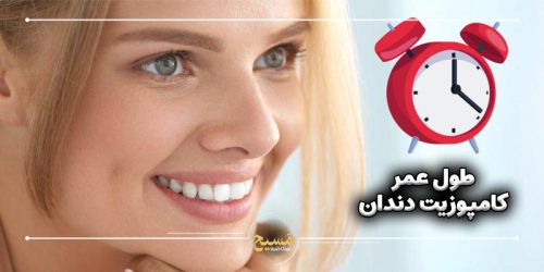 طول عمر کامپوزیت دندان