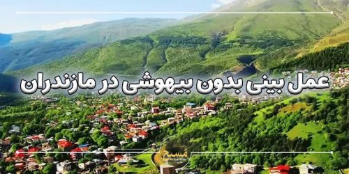 عمل بینی بدون بیهوشی در مازندران