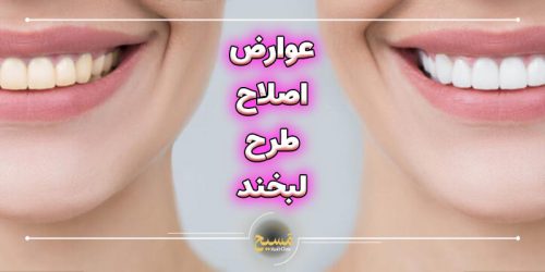 عوارض اصلاح طرح لبخند