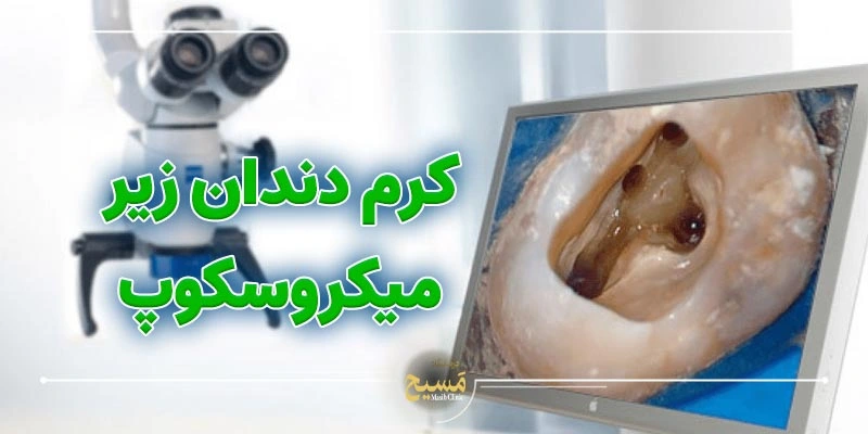 کرم دندان چه شکلی است 1 عکس کرم دندان زیر میکروسکوپ