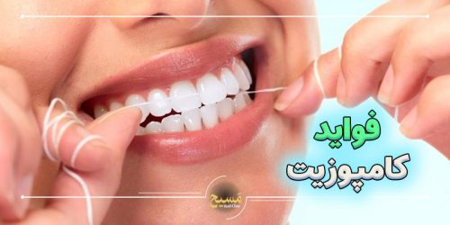 فواید کامپوزیت دندان