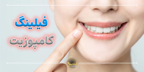 فیلینگ کامپوزیت