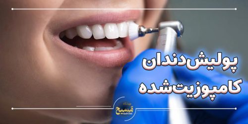 پولیش دندان کامپوزیت شده