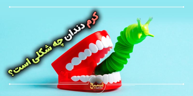 کرم دندان چه شکلی است 2 کرم دندان