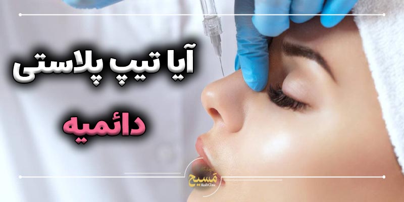 ایا تیپ پلاستی دائمی است 1 آیا تیپ پلاستی دائمی است؟