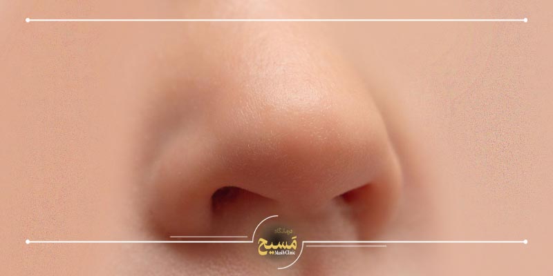 هزینه عمل بینی پهن و گوشتی 2 بهترین جراح عمل بینی گوشتی و پهن