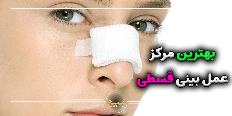 هزینه عمل بینی اقساط 1 بهترین مرکز عمل بینی اقساطی