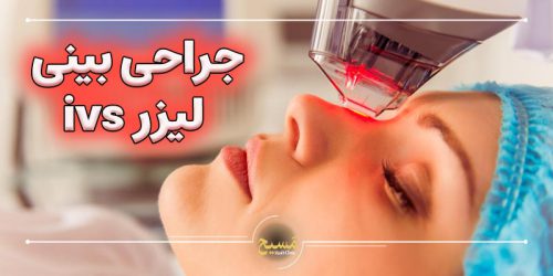 جراحی بینی بدون بیهوشی با روش جدید لیزر ivs