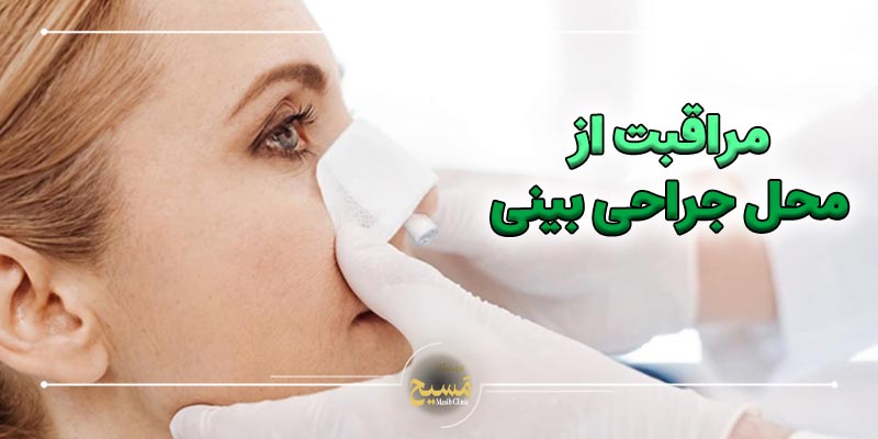 مراقبت های بعد از رینوپلاستی بینی 1 مراقبت از محل جراحی