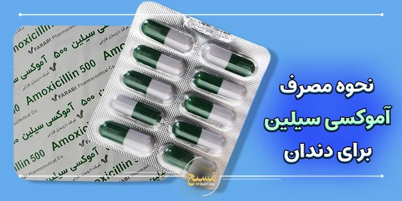 نحوه مصرف آموکسی سیلین و مترونیدازول برای عفونت دندان 1 نحوه مصرف آموکسی سیلین برای دندان