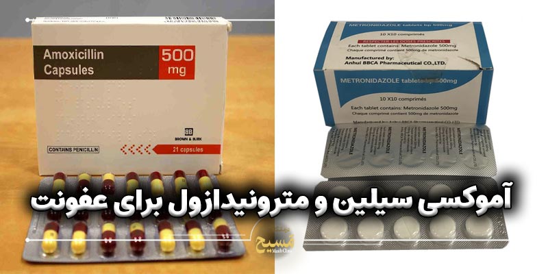 نحوه مصرف آموکسی سیلین و مترونیدازول برای عفونت دندان