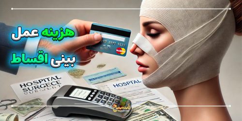 هزینه عمل بینی اقساط