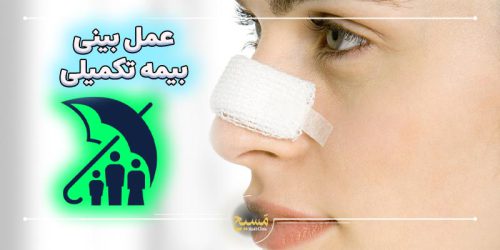 هزینه عمل زیبایی بینی با بیمه تکمیلی