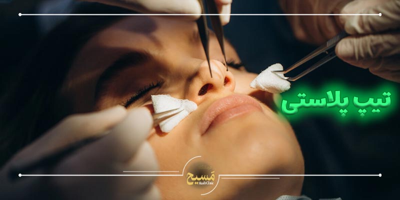 تیپ پلاستی سریع و بی دردسر