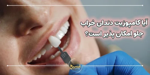 آیا کامپوزیت دندان خراب جلو امکان پذیر است؟